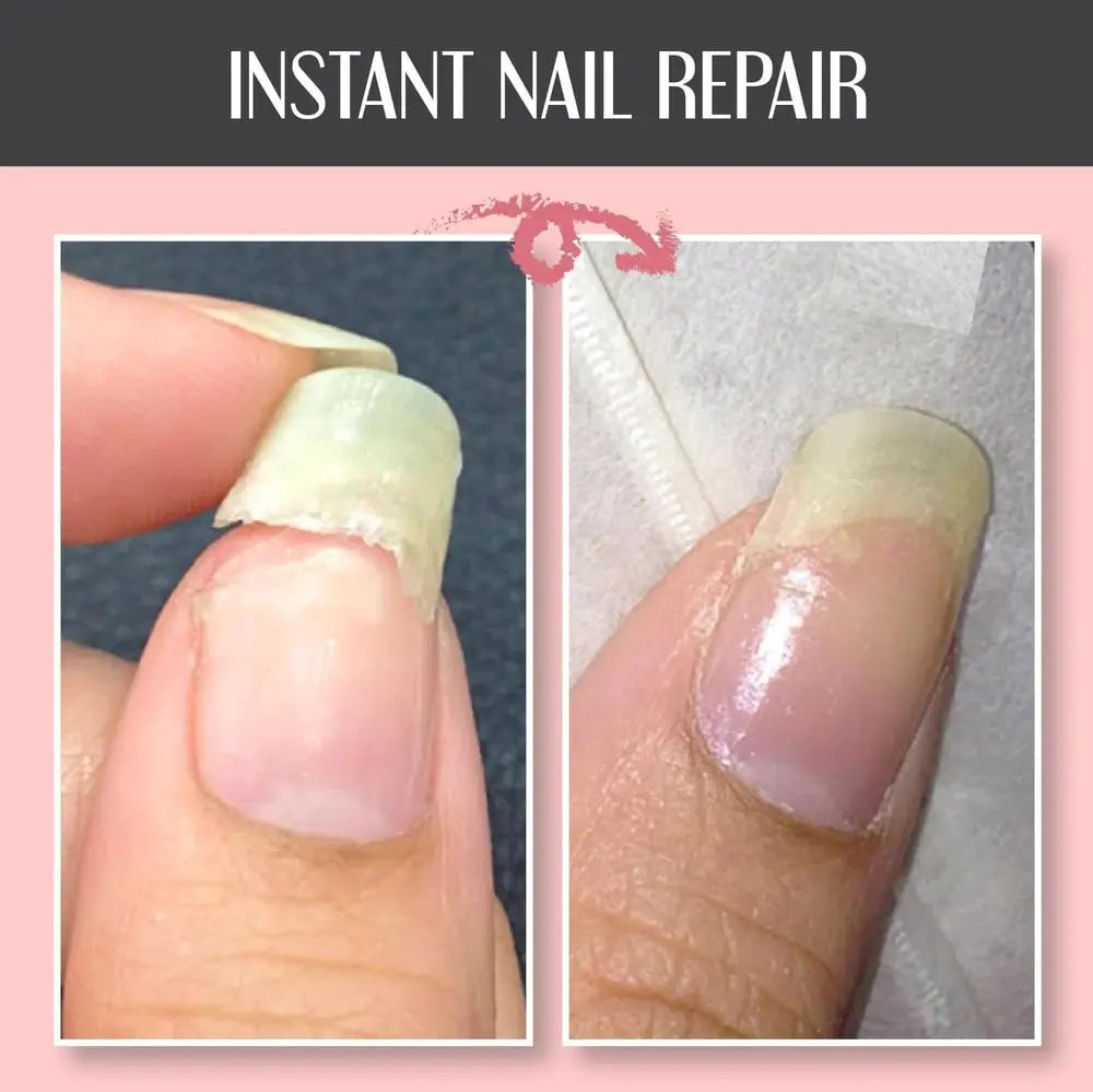 🔥Nail Repair Protection Gel Zorenza