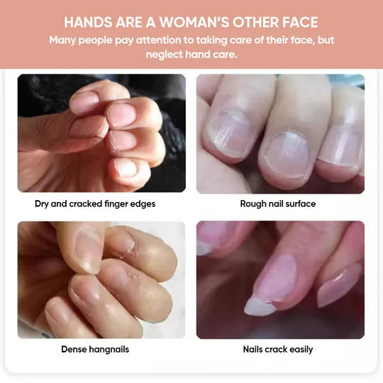 Nail Care Oil — Strong Nails, Radiant Confidence Homezys