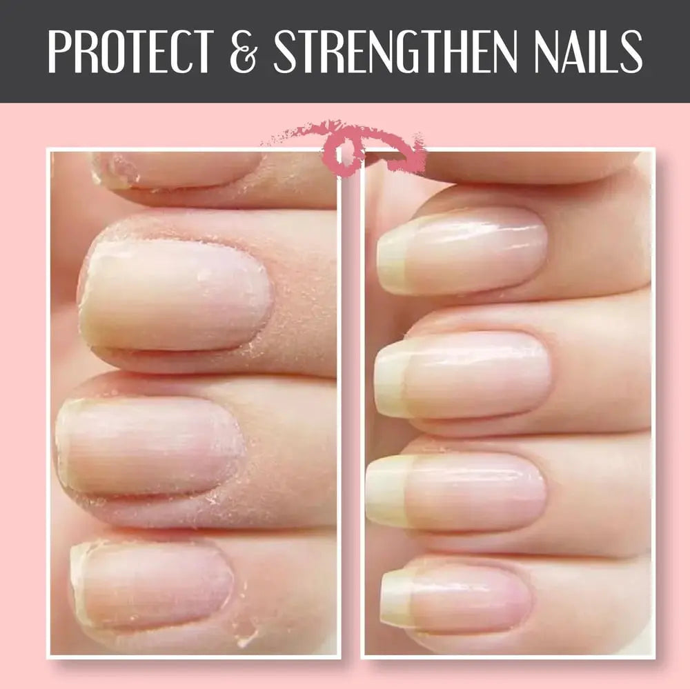 🔥Nail Repair Protection Gel Zorenza