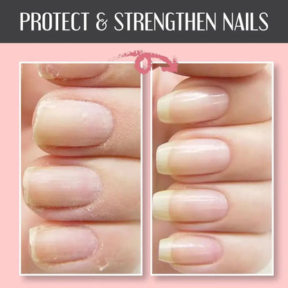 🔥Nail Repair Protection Gel Zorenza