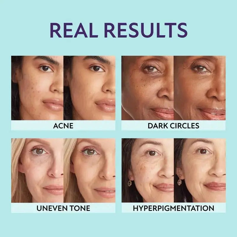 Supreme Crème – All-in-one moisturizer, concealer & coverage 💧✨ Lightweight & waterproof Zorenza