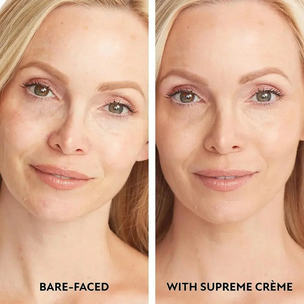 Supreme Crème – All-in-one moisturizer, concealer & coverage 💧✨ Lightweight & waterproof Zorenza